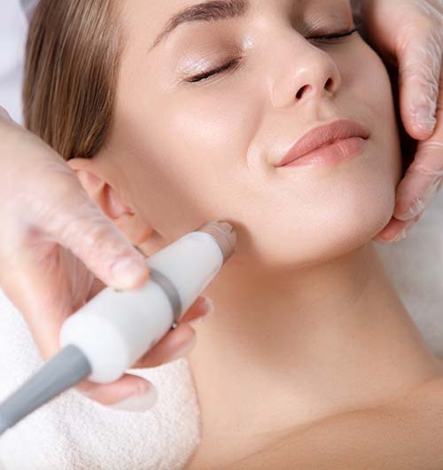 IPL Photofacial IPL Photofacial